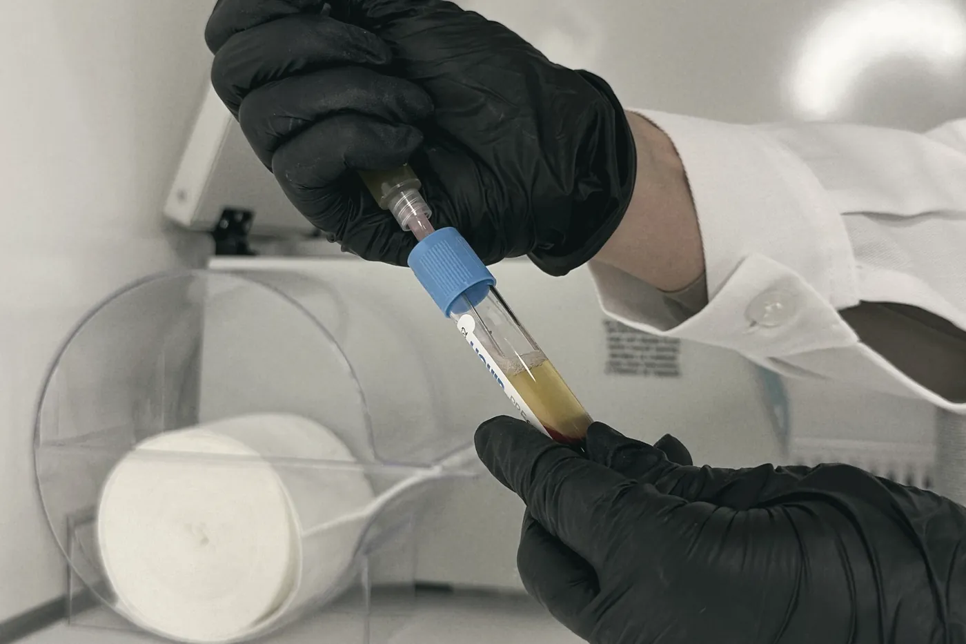 Gloved hands handling a sample tube in a clinic